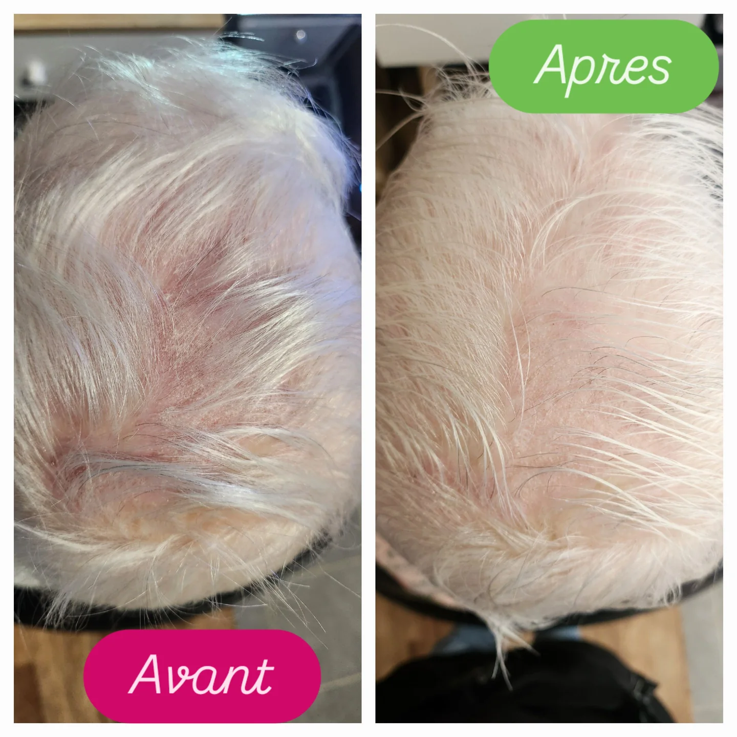Deux gros plans comparatifs de cheveux clairs et du cuir chevelu.